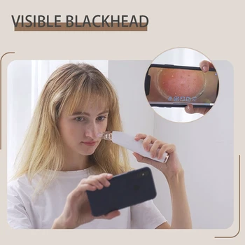

Blackhead Remover Face Pore Vacuum Skin Care Acne Pore Cleaner Pimple Removal Vacuum Suction Facial Skin Tools USB Rechargeable