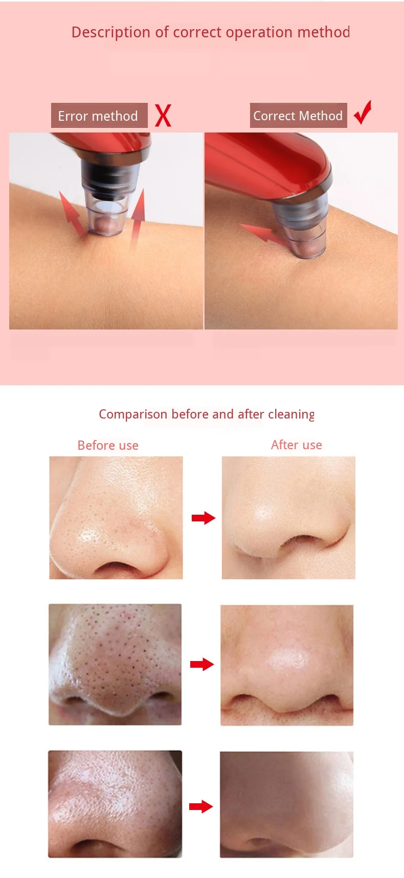 Máquina de Cuidados com a Pele Cuidados com o Rosto Elétrica Cravo Acne Removedor Rosto Exportação Instrumento Beleza Poros Profundos Mais Limpo 17 cuidados com a pele rosto cravo exportação