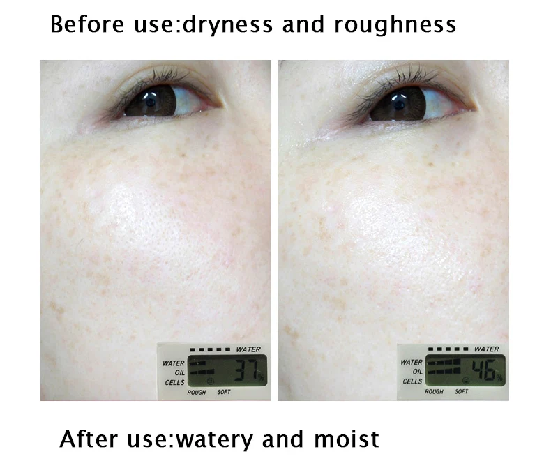 20180710_103321_010