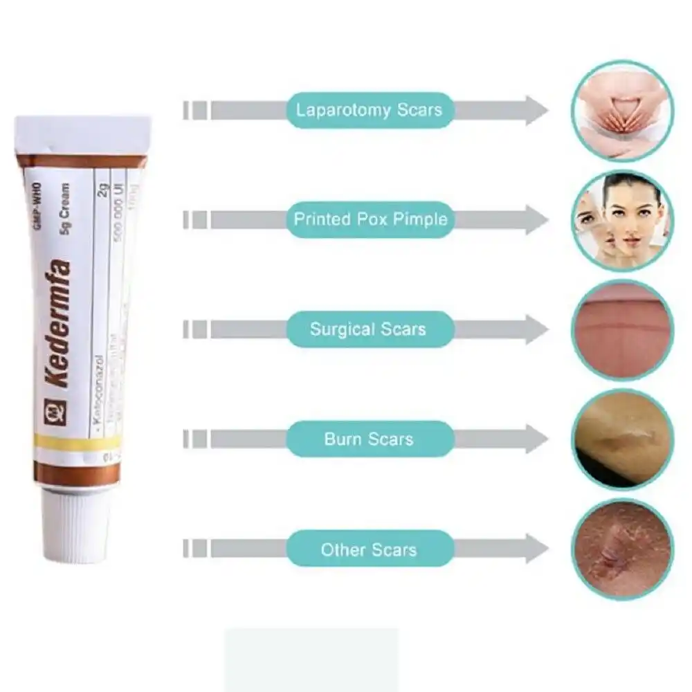 burning spot removal cream