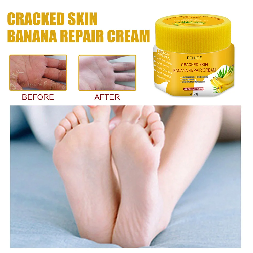 Treeology Cracked Heel Repair Foot Cream – Spatz India