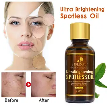 

Brightening Spotless Oil Skin Whitening Natural Pure Remove Dark Spots