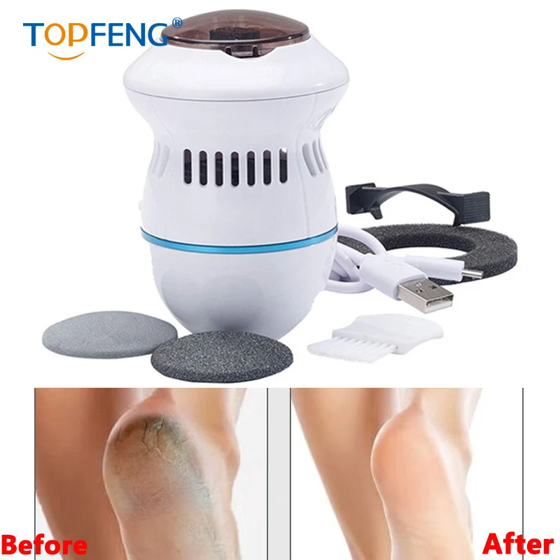 

TopFeng Pedi Remover Vac Rechargeable Electronic Foot Files Clean Tools Feet Care Perfect for Hard Cracked Skin Dropshipin