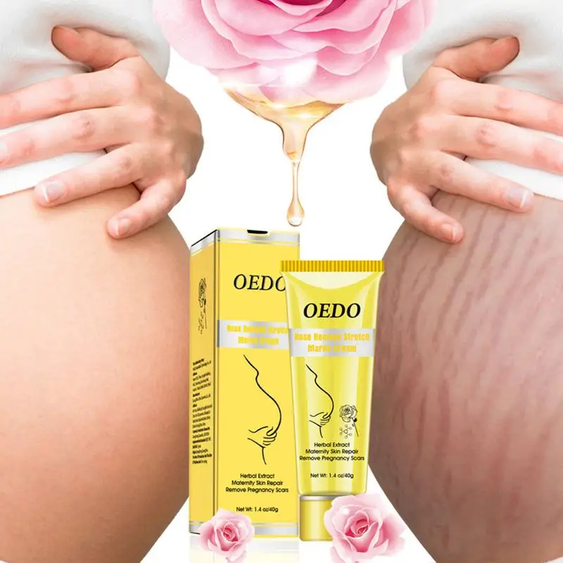 

Maternity Repair Anti Winkles Cream Scar Removal Cream Rose Remove Pregnancy Scars Acne Cream Stretch Marks Treatment TSLM1