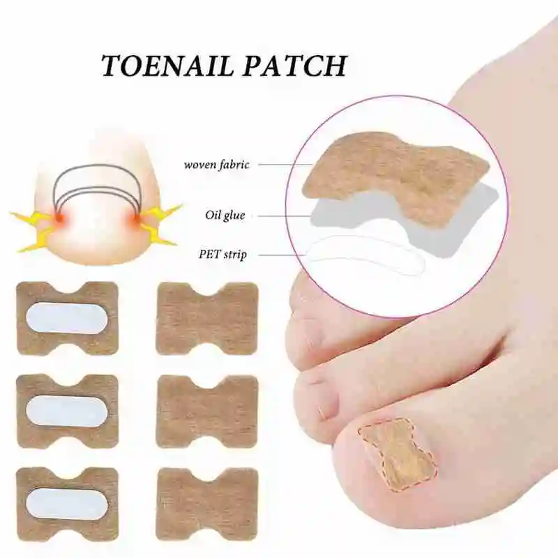 10pcs Ingrown Toenail Corrector Stickers Fingernail Toe Nail Corrector Patch Paronychia Inlays Treatment Care Pedicure Tools Hot