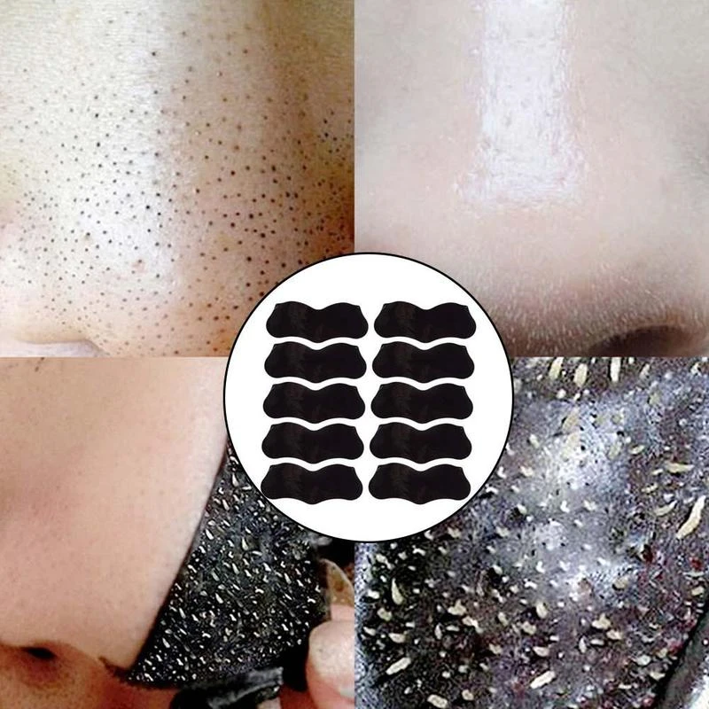 100Pcs Nose Blackheads Remove Mask Plaster Nose Strips Remove Blackheads Pores Black Dot Remover Acne Peel Mask Cleaning Patch