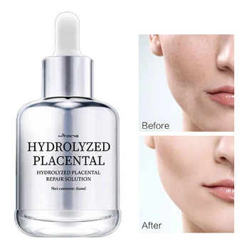 

Anti Aging Moisturizing Whitening Repair Stock Solution Anti Winkle Shrink Pore Smooth Fine Line Skin CarePlacenta Face Essence