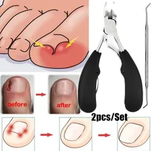 Носок кусачки для ногтей, ногти для ног "францзуский маникюр" лечение коррекция ногтей кусачки для стрижки кусачки для удаления омертвевшей кожи лечение заболеваний стоп для педикюра, инструмент для ухода за ногами