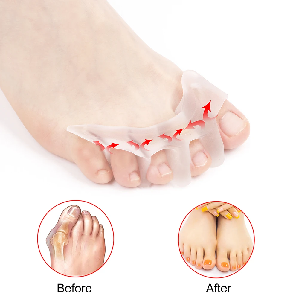 

Reusable Toe Separator Toe Orthopedic Supplies Separator Stretcher Hallux Valgus Bunion Corrector Bunion Silica Gel Foot Care