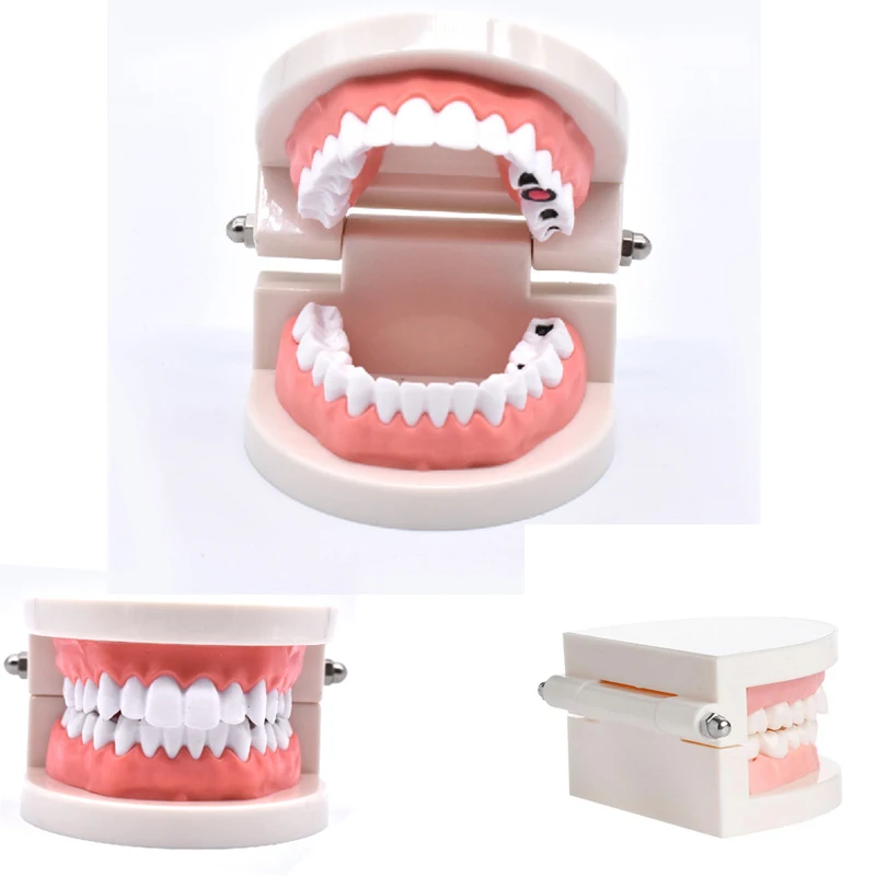 

1 pcs Teeth Model Standard Tooth Teaching Dental Child Kid training Model Disease Teeth Medical Model Disease Teaching Study