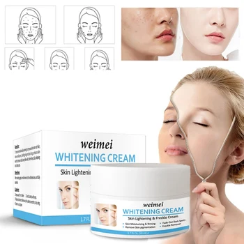 

Whitening Cream Face Moisturizing Cream Anti Wrinkle Anti Aging Face Fine Lines Acne Treatment Skin Care for Women