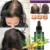 30/2010 МЛ Эффективная Сыворотка для Роста Волос Fast Thick for Hair Prevent Hair Loss Damaged Hair Repair Natural Hair Care Products