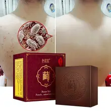 Натуральная формула, антиклещи, деликатная пенка, увлажняющая, удаляет акне, восстанавливает кожу, укрепляет, отбеливает кожу, мыло ручной работы