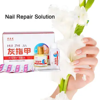 

Fungal Nail Treatment Feet Care Essence Nail Foot Whitening Onychomycosis Removal Nail Toe Anti Paronychia Infection Fungus G0K9