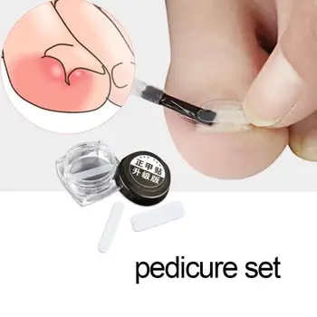 

1 Set Toe nail Patch Ingrown Correction Tool Set Toe Care Clip Pusher Recover Foot Nail Toenail Straightening Ingrown Patch A3A3