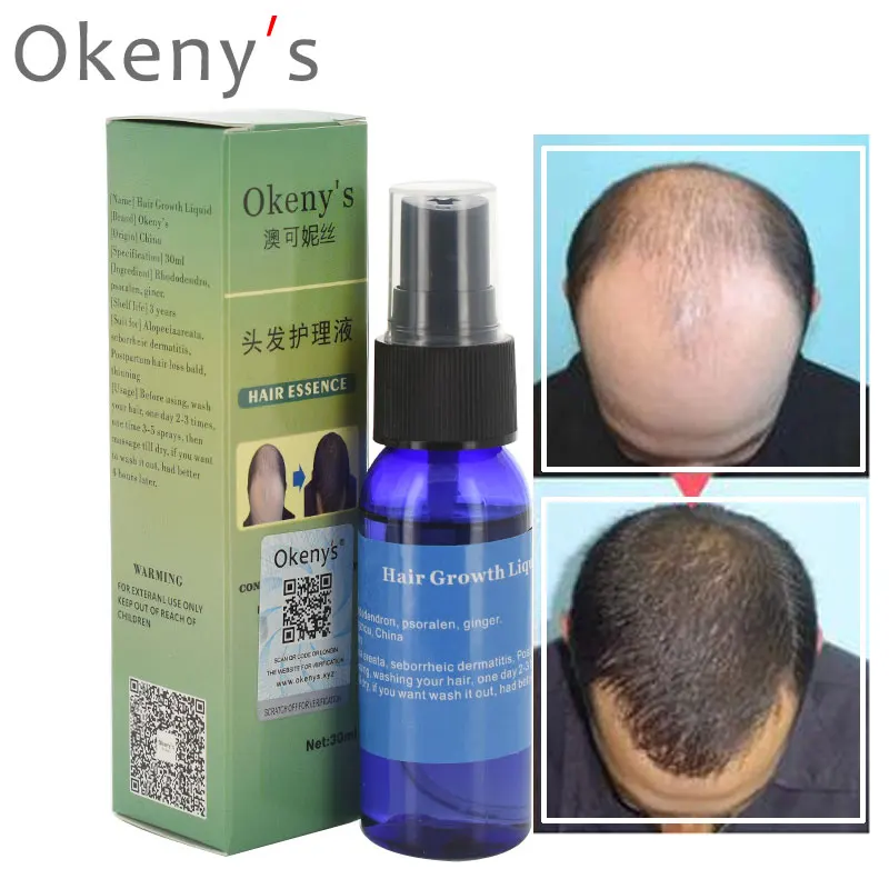 3 типа s эфирное масло для роста волос Okeny's для женщин и мужчин быстро увеличивает интенсивное восстановление волос средство против выпадения волос