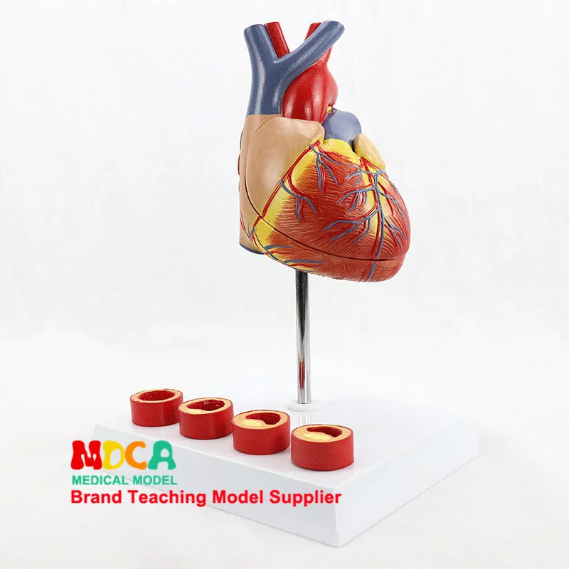 

Human Body 1: 1 Natural Large Luxury Heart with 4-Stage Vascular Anatomical Model Cardiovascular Medicine Teaching Mxz002