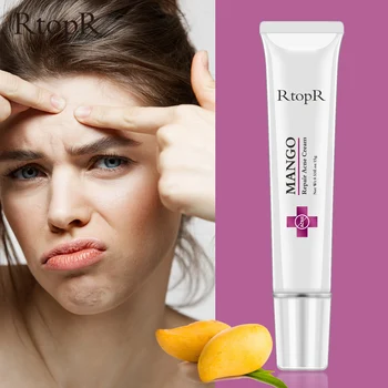 

Mango Repair Acne Cream Anti Acne Spots Acne Treatment Scar Blackhead Cream Shrink Pores Whitening Moisturizing Face Skin Care