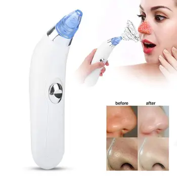 

Hot Blackhead Remover Face Deep Pore Cleaner Acne Pimple Removal Vacuum Suction Facial Beauty Care Tool Skin Care No Battery
