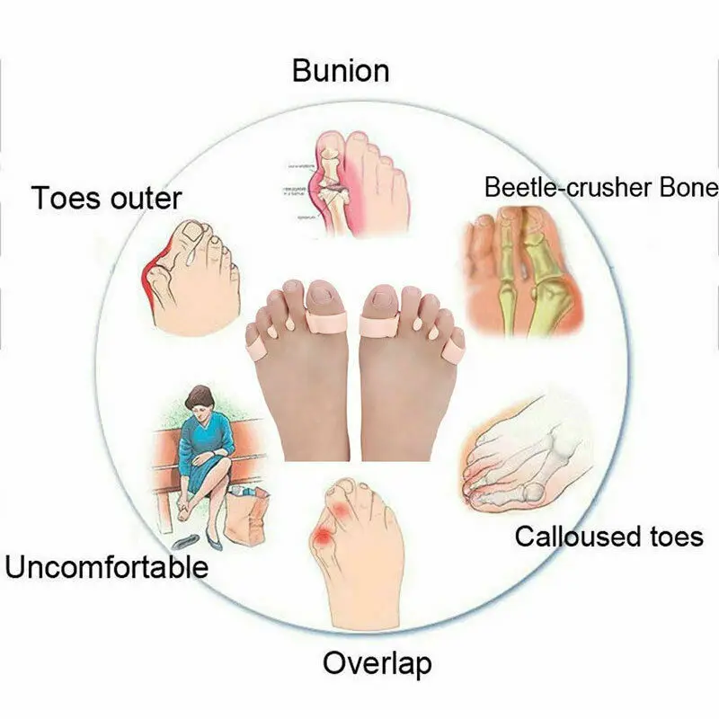 1 Pair Toe Separators Soft Silicone Corrector Toe Separator Flexible Finger Spacer Flexible Finger Spacer Preventing Blisters