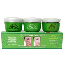 Золотой отбеливающий алоэ противошрамный от веснушек дневной крем+ ночной крем+ жемчужный крем отбеливающий крем для лица Питательный