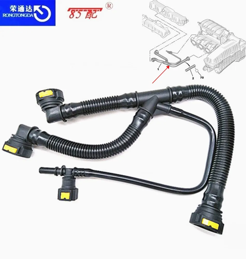 Воздуходувные трубки системы двигателя 1192W0 9675884280 TU5JP4 для Pengeot 206/207/301/307/308/408 citroen