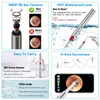 New 5MP Wifi Ear Wax Cleaner Otoscope UV Sterilizer 3.9mm Wireless Visual Nasal Endoscope Camera for ISO Android Device 4