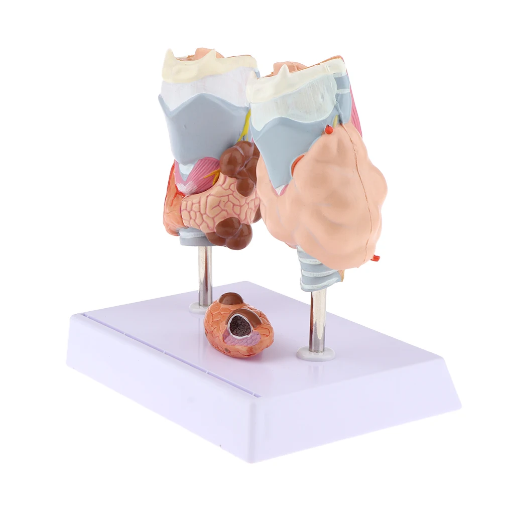 Human Anatomical Thyroid Gland Pathology Anatomy Medical Teaching Model - Lab Supplies Science Classroom Education