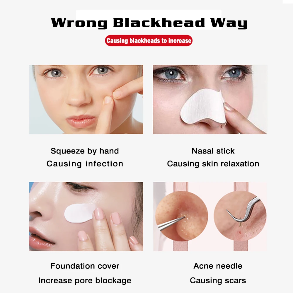 Face Nose Acne Black Dot Remover пылесос для чистки пор Сменный наконечник Электрический пылесос Инструменты для ухода за кожей Машина