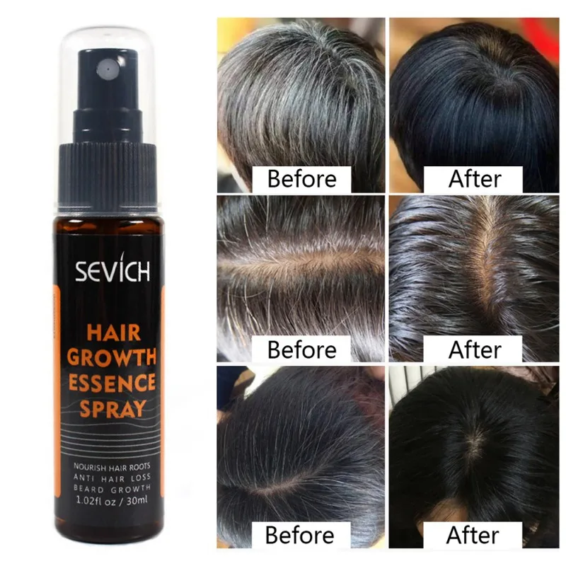 Effective Hair Growth Essence Spray Nourishing Scalp Enhance Tenacity Anti-Hair Loss Serum | Красота и здоровье