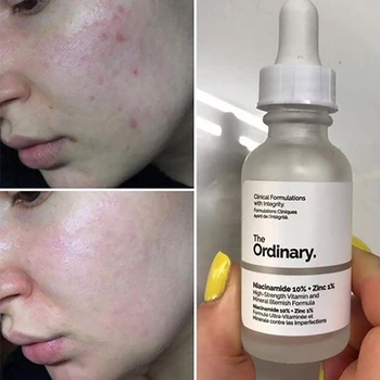 

The Ordinary Niacinamide 10% + Zinc 1% 30ML Face Serum Oil Balance Reduce Skin Blemishes Whitening lasting Moisturizer Primer