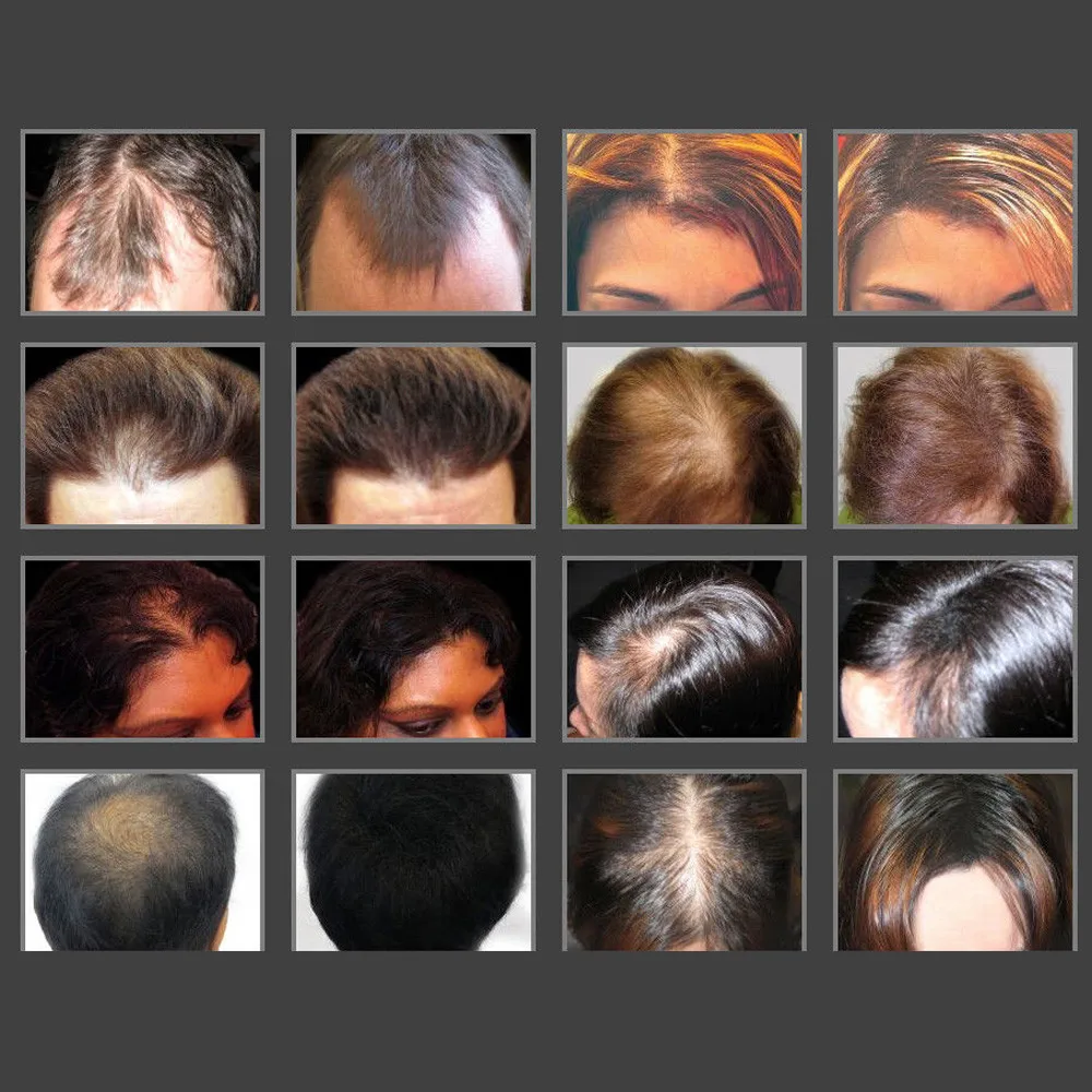 Кератиновые Волокна Для Волос Купить