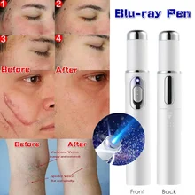 Blu-ray In Addition Acne Pen Facial Acne Scar Removal Repair Beauty Bar Tightening Pore Rejuvenation Skin Care Beauty Instrument