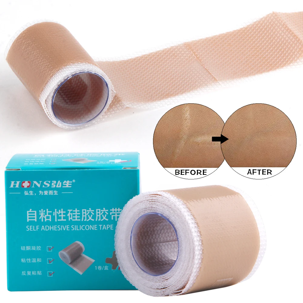 Silicone Scar Sheets Removal Patch Acne Gel Scar Therapy Silicon Patch