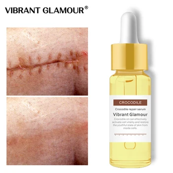 

VIBRANT GLAMOUR Crocodile Repair Scar Face Serum Removal Acne Scar Whitening For Spots Acne Treatment Stretch Marks Skin Care
