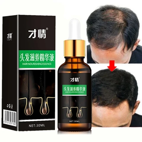Care Hair Growth Essential Oils Essence Original Authentic 100% Hair Loss Liquid Health Care Beauty Dense Hair Growth Serum