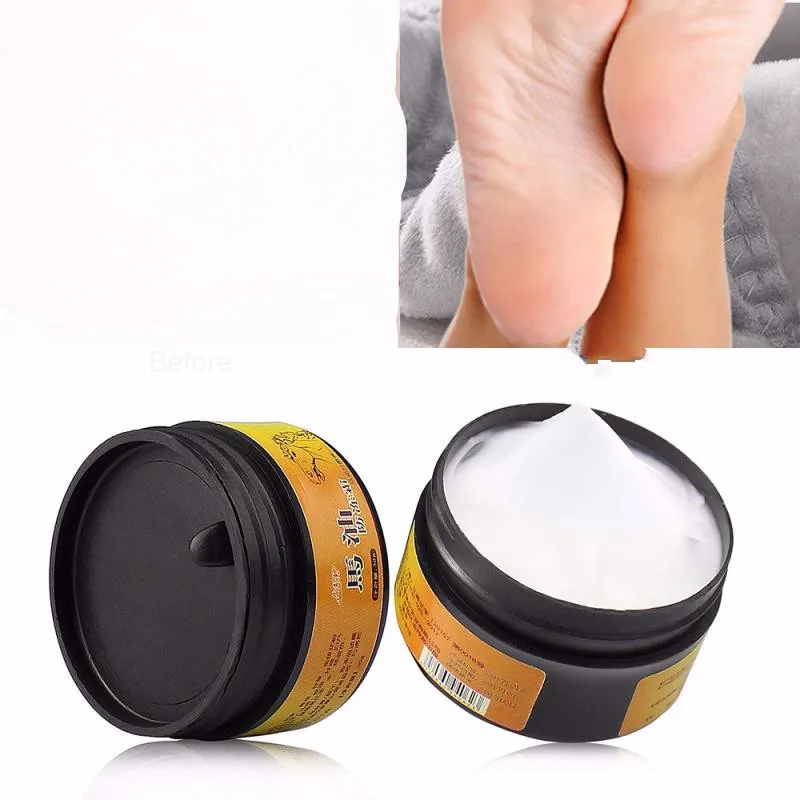 

Natural Horse Oil Foot Anti-chapping Cream Winter Hand Foot Peeling Repair Cream Or Athlete's Feet Itch Blisters Foot Care TSLM2