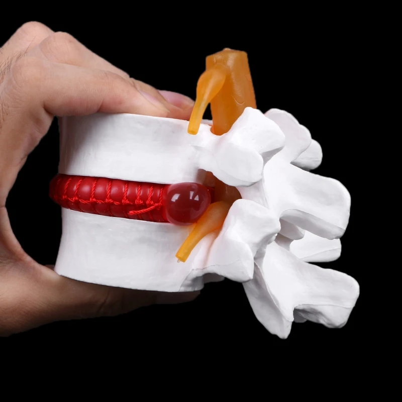 Medical Lumbar Disc Model Human Anatomical