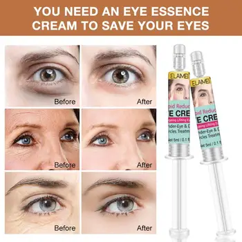 

2PC Rapid Instantly Eye Cream Remove Dark Circle Fine Lines Eye Bag Against Aging Deep Moisturizing Eye Cream Skin Care Dropship