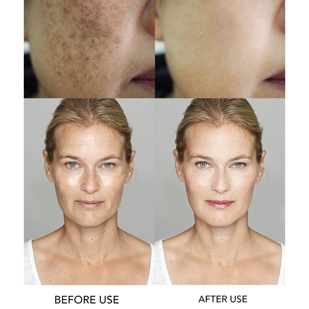 AILKE Superior Lighten Vitamin C Face Serum, Moisturizes, Hydration, Remove Hyperpigmentation, Black Spots, Freckles, Clean Skin