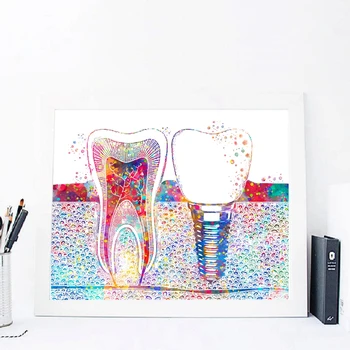 

Watercolor Poster Tooth Implant Print Dentist Gift Dental Clinic Wall Decor Hygienist Office Art Medicine Canvas Painting