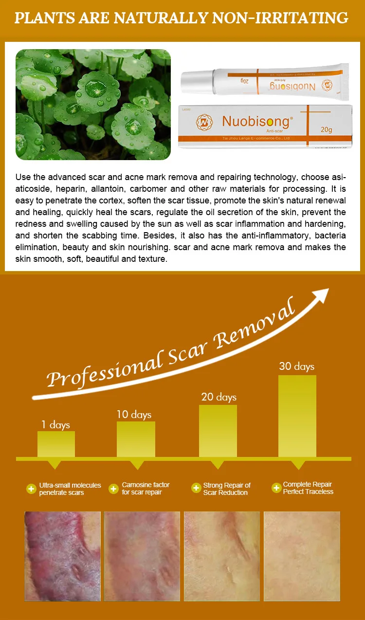 20 г Nuobisong уход за кожей лица Прыщи Шрам удаление растяжек лечение от прыщей, отбеливание увлажняющий крем TSLM2