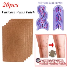 

5/10/20/40Pcs Gezondheidszorg Spider Body Natuurlijke Patches Spataderen Cure Patch Spataderen behandeling