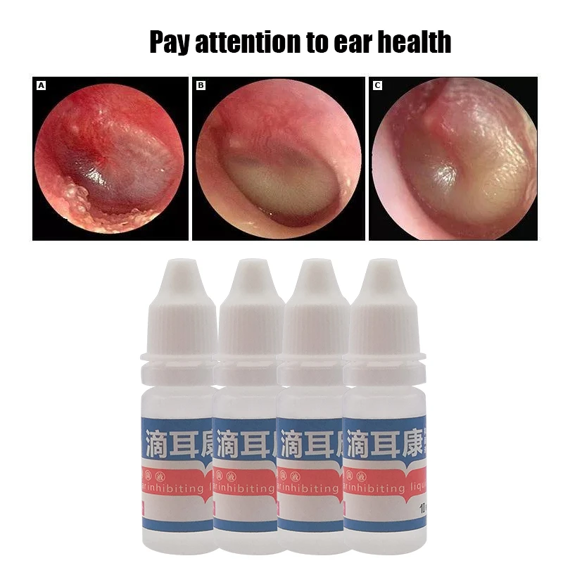 1pcs 10ml Chinese Herbal Medicine Treatment Ear Acute Otitis Spray Ear