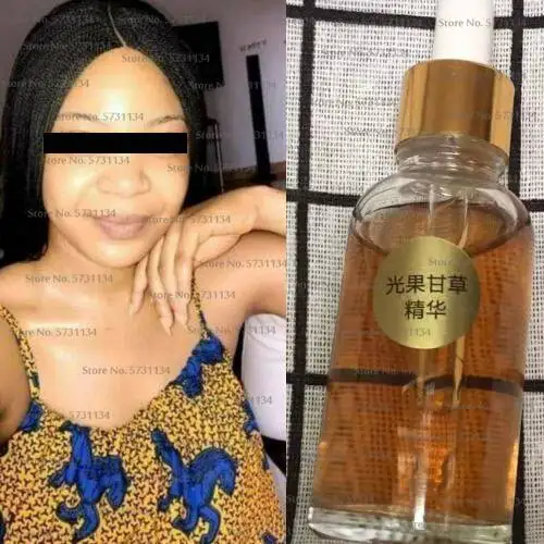 Authentic Strong Whitening Serum for Dark Skin Lightening Lotion for Dark Knuckles, Elbows, Fingers and Inner Thighs