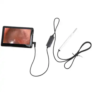 

USB Charging Inspection Ear Cleaning Endoscope Visual Ear Spoon Earpick
