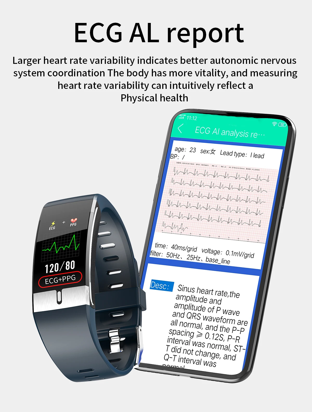 Água para Androd Ecg + Ppg Ip68 à Prova Jusutek Relógio Inteligente Super Multifunções Cardio Bluetooth Pulseira Pressão Arterial Dip68 Ios 2021new 9 Eletrônicos