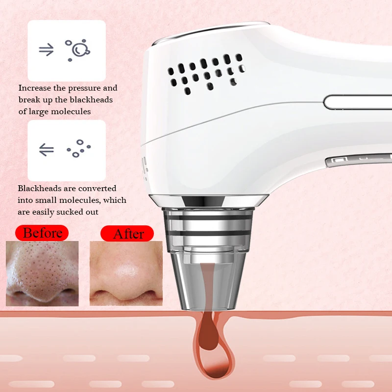 US $40.26 CF042 Blackhead Remover Face Pore Vacuum Black Point Extractor Pimple Removal Acne Cleaner Skin Care Tool Cold Hot Facial Beauty