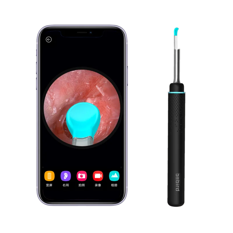  Xiaomi Bebird M9 Pro Smart Visual Ear Stick Black 17 in1 300w High Precision Endoscope 350mAh with 