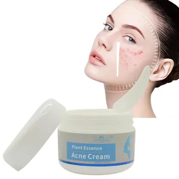 

50g Acne Remover Cream Beauty Care Acne Scars Blackhead Removal Cream Whitening Beauty Acne Treatment Face Cream